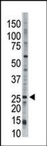 UBE2E3 Antibody in Western Blot (WB)