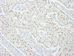 UBE1 Antibody in Immunohistochemistry (IHC)