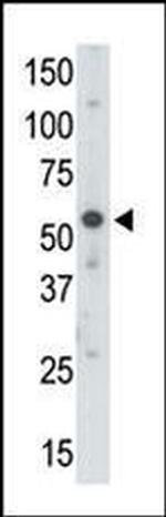 UBA3 Antibody in Western Blot (WB)