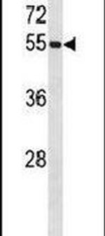 UBA3 Antibody in Western Blot (WB)