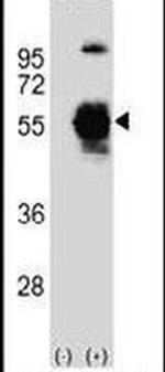 UBA3 Antibody in Western Blot (WB)