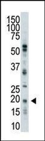 UBE2C Antibody in Western Blot (WB)