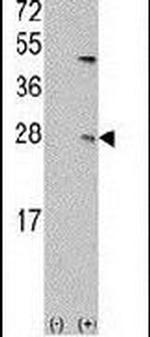 UBE2C Antibody in Western Blot (WB)