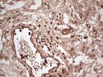 UBE2D2 Antibody in Immunohistochemistry (Paraffin) (IHC (P))