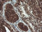 UBE2E3 Antibody in Immunohistochemistry (Paraffin) (IHC (P))