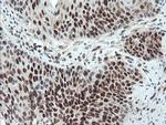 UBE2E3 Antibody in Immunohistochemistry (Paraffin) (IHC (P))