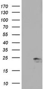 UBE2E3 Antibody in Western Blot (WB)