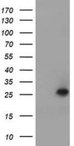 UBE2E3 Antibody in Western Blot (WB)