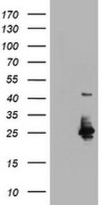 UBE2E3 Antibody in Western Blot (WB)