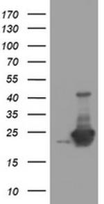 UBE2E3 Antibody in Western Blot (WB)