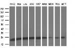 UBE2E3 Antibody in Western Blot (WB)