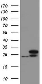 UBE2E3 Antibody in Western Blot (WB)