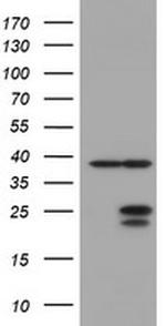 UBE2E3 Antibody in Western Blot (WB)