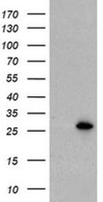 UBE2E3 Antibody in Western Blot (WB)