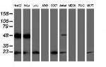 UBE2E3 Antibody in Western Blot (WB)