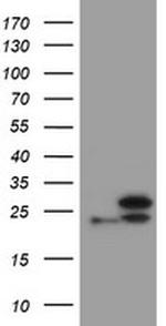 UBE2E3 Antibody in Western Blot (WB)