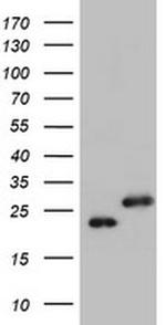 UBE2E3 Antibody in Western Blot (WB)