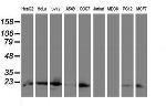 UBE2E3 Antibody in Western Blot (WB)
