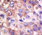 UBE2G1 Antibody in Immunohistochemistry (IHC)