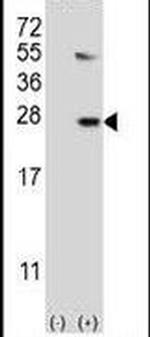 UBE2G1 Antibody in Western Blot (WB)
