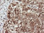 UBE2G2 Antibody in Immunohistochemistry (Paraffin) (IHC (P))