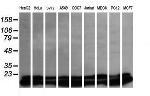 UBE2G2 Antibody in Western Blot (WB)