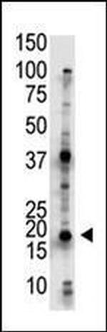 UBE2G2 Antibody in Western Blot (WB)