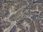 UBE2J1 Antibody in Immunohistochemistry (Paraffin) (IHC (P))