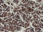 UBE2J1 Antibody in Immunohistochemistry (Paraffin) (IHC (P))