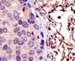 UBE2L3 Antibody in Immunohistochemistry (IHC)