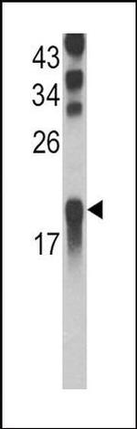 UBE2L3 Antibody in Western Blot (WB)