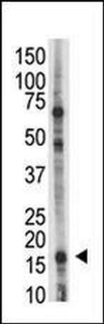 UBE2L6 Antibody in Western Blot (WB)
