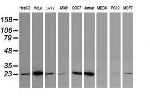 UBE2S Antibody in Western Blot (WB)