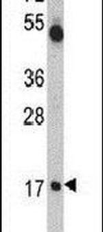 UBE2V1 Antibody in Western Blot (WB)