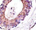 UBE4A Antibody in Immunohistochemistry (IHC)