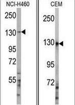 UBE4A Antibody in Western Blot (WB)