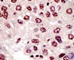 UBE4B Antibody in Immunohistochemistry (IHC)