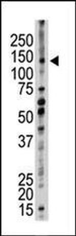 UBE4B Antibody in Western Blot (WB)