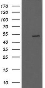 UBOX5 Antibody in Western Blot (WB)