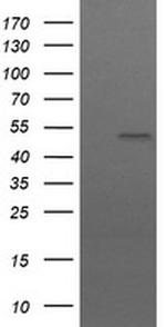 UBOX5 Antibody in Western Blot (WB)
