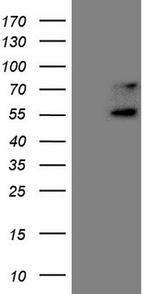 UBP1 Antibody in Western Blot (WB)