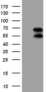 UBP1 Antibody in Western Blot (WB)