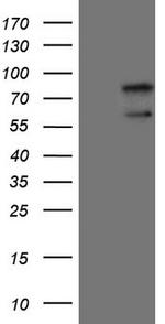 UBP1 Antibody in Western Blot (WB)