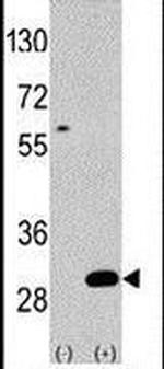 UBTD1 Antibody in Western Blot (WB)