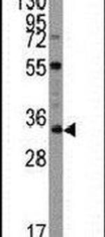 UBTD1 Antibody in Western Blot (WB)