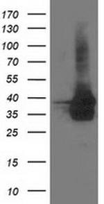 UBXN2B Antibody in Western Blot (WB)