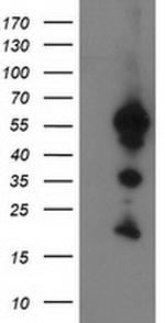 UBXN2B Antibody in Western Blot (WB)