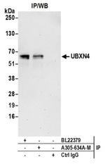 UBXN4 Polyclonal Antibody