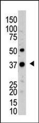 UCH37 Antibody in Western Blot (WB)