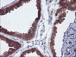 UCHL1 Antibody in Immunohistochemistry (Paraffin) (IHC (P))